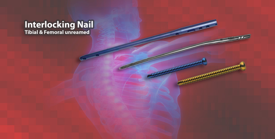 Interlocking Nail Tibial und Femoral Interlocking Nail Tibial und Femoral