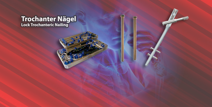 Trochanter Nagel Trochanter Nagel