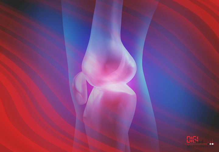 Oberschenkel Implantate und Instrumente von digimed Medizintechnik Oberschenkel Implantate und Instrumente von digimed Medizintechnik